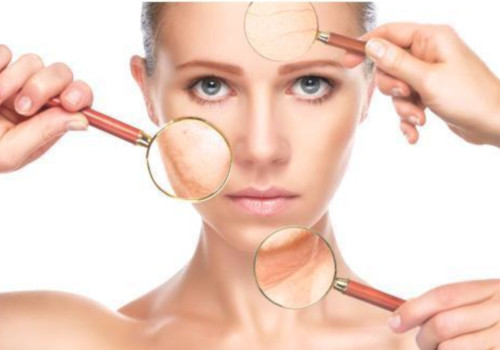 Anti pigmentation - Hair removal laser treatment at GEM Skin, Hair and Laser Centre