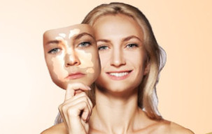 Vitiligo - Best skin doctors at GEM Skin, Hair and Laser Centre