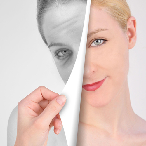 Anti aging - Anti-aging treatment in Madurai at GEM Skin, Hair and Laser Centre