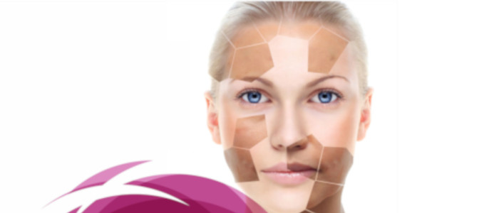 Anti pigmentation top - Anti pigmentation treatment in Madurai at GEM Skin, Hair and Laser Centre