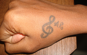 Tatto before - YAG laser treatment for tattoo removal in Madurai at GEM Skin, Hair and Laser Centre