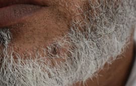 Largeskintag2 - Medi facial treatment for skin problems at GEM Skin, Hair and Laser Centre